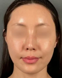 b&a7 b&a7