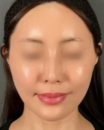b&a8
